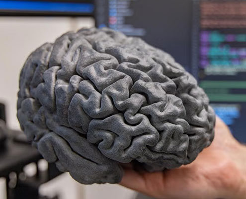 Engineers, Neurosurgeons Help Restore Autonomy for People with Paralysis